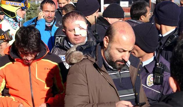 Milli Takım seçmelerinde olay çıktı... 2 kişi yaralandı!