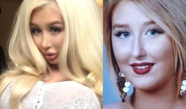 Barbie'ye benzemek için üst üste ameliyatlar geçirdi!