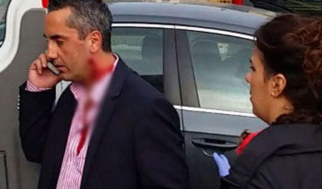 Burak Altındal'ın başına gelmeyen kalmadı! Şimdiye kadar 5 canını kullandı bile...