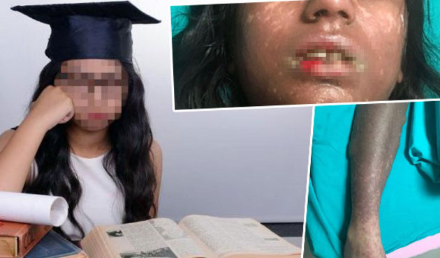 Sınav kaygısı için gittiği doktor bu hale getirdi!
