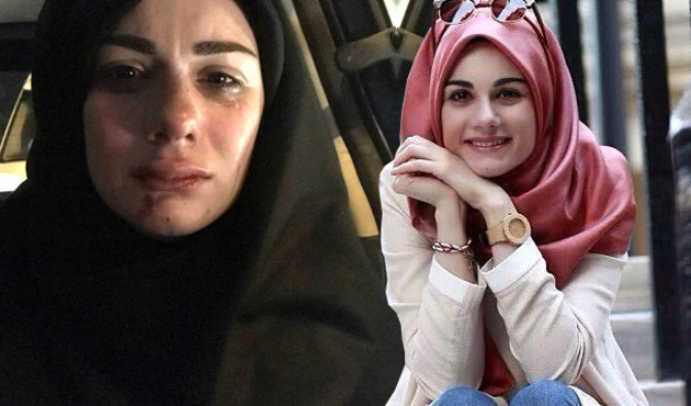 Ünlü Youtuber Elif Kübra Genç darp edildi!