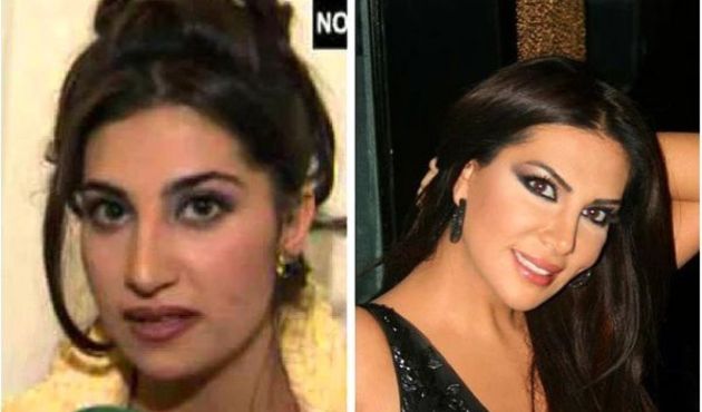 Ebru Yaşar 'Estetiğim yok, ufak tefek dokunuşlar var' dedi!