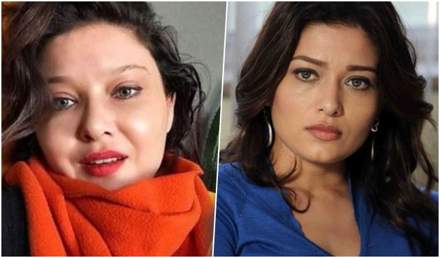 Nurgül Yeşilçay'ı kızdıracak botoks yorumu!