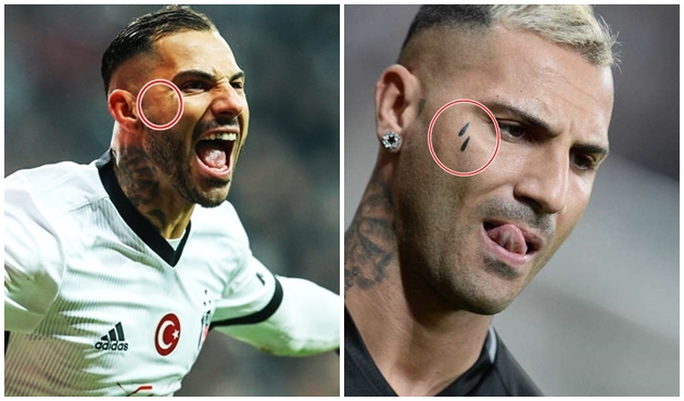 Quaresma çok tartışılan dövmesini sildirdi!