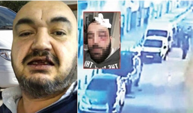 Velhasıl onlar vurdu, UBER büyüdü kardeşim!