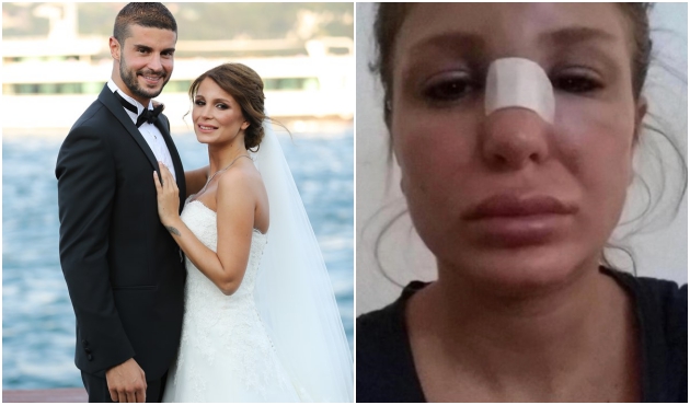 Berk Oktay'a korkunç suçlama: Kocam beni dövdü!
