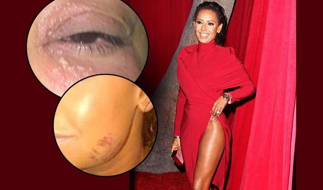 Mel B’nin boşanma davasından sızan şiddet iddiaları