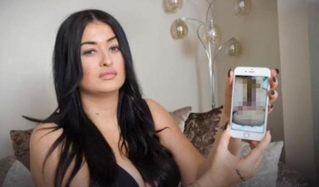 Kardashian kalçası yaptırmak için Türkiye'ye gelen genç kadına şok!