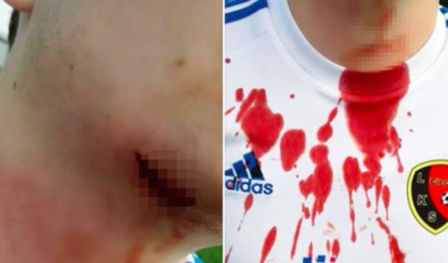 Futbolcunun boğazını bıçakla kesti!