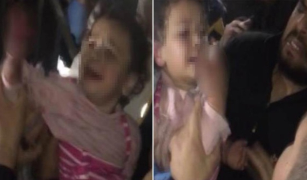 Suriyeli çocuğun parmakları koptu!