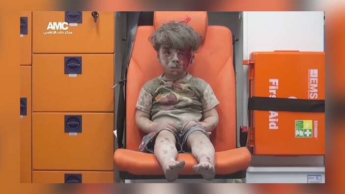Dünyayı sarsan Suriyeli Ümran tek kelime bile konuşmuyor