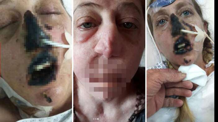 Fare ısırdı hayatı kabusa döndü! Burnu, dudakları, bacakları ve kolları kesildi...