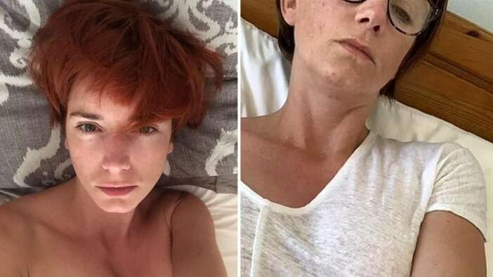 Ünlü model koronavirüs aşısı olduktan bir kaç gün sonra hayatını kaybetti!