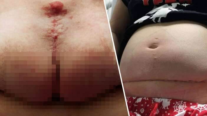 Duyanlar şoke oluyor: Doktorlar "Bu bebeği öldürelim" dedi!