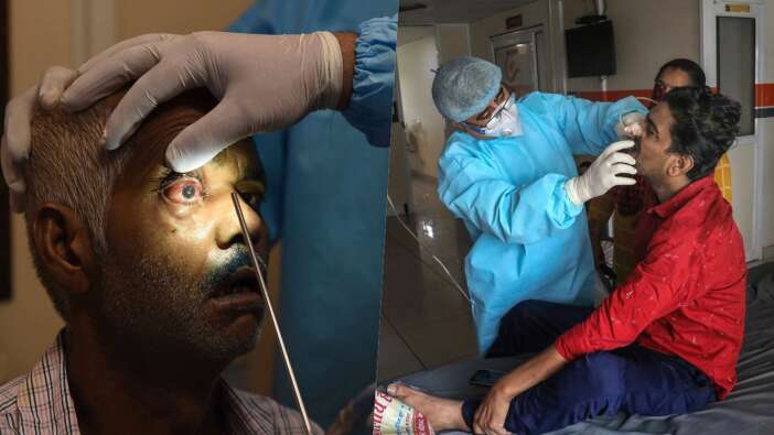 Hindistan'da ortaya çıkan 'kara mantar' hastalığı Umman'dan sonra Arjantin'de de görüldü