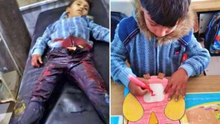 İnsanlık, Suriye'de öldü! Onu Esad ve Rus pilotlar öldürdü!