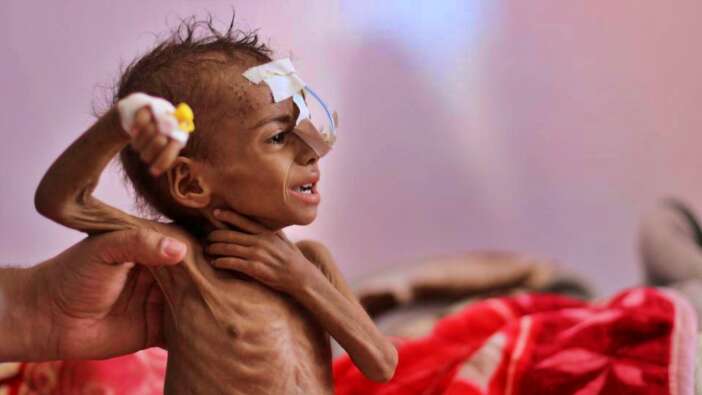BM Dünya Gıda Programı: Fonumuz azaldı, Yemen'e gıda yardımını kestik!
