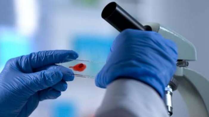 AIDS vakalarını 2 katına çıkaracak yeni bir HIV varyantı tespit edildi