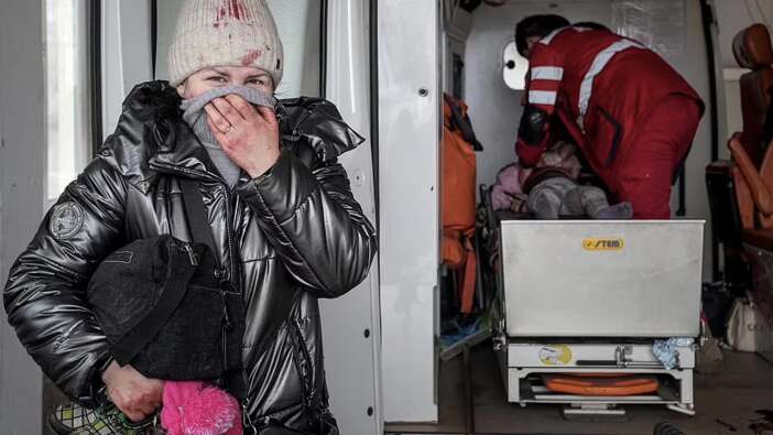 Savaşın acısını en çok çocuklar çekiyor! Pembe pijamasıyla hafızalara kazındı