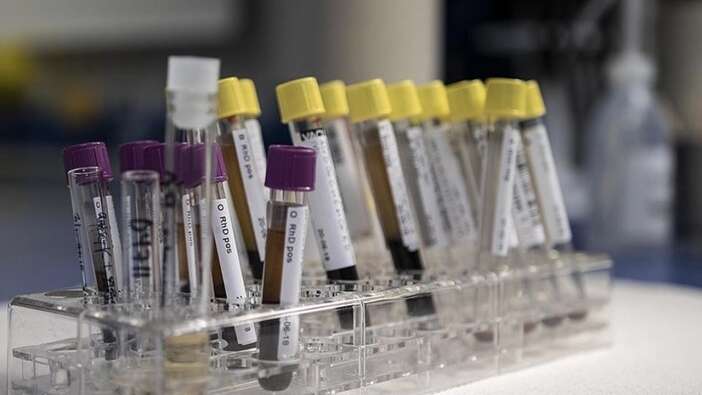Gizemli hepatit virüsü tehlike saçıyor: Bir ülkede daha çıktı