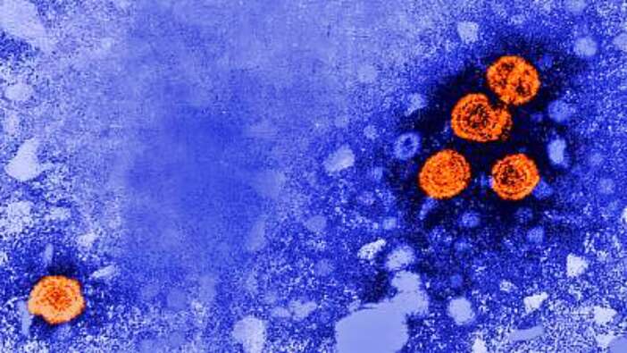 Gizemli hepatit virüsü dünyaya yayılıyor!