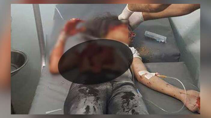 Katliamı TSK duyurdu: PKK, Mare'de sivilleri öldürdü!