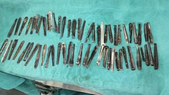 Karın ağrısı şikayetiyle hastaneye gitti, gerçek ortaya çıktı