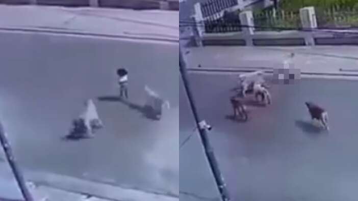 Korkunç görüntüler: Sokak köpekleri küçük kıza saldırdı! Durumu kritik