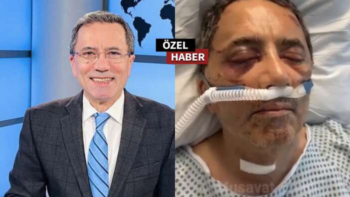 Amerika’da Türk gazeteciye saldırı! Muhalif gazeteci ve oğlu ağır yaralandı!