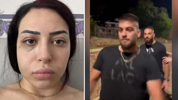 Kıbrıs Türkü Asya Karaali’ye 3 Rum erkekten ırkçı saldırı! Parmaklarını kırıp duvardan attılar