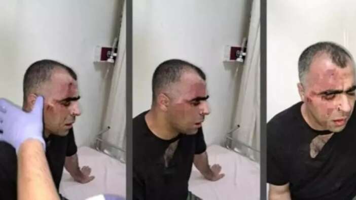 Bitlis'te gazeteci Sinan Aygül'ü darp eden belediye çalışanı ve polis memuru tutuklandı