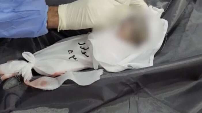 Bunun adı vahşet: İsrail Gazze'de anne karnındaki ikiz bebekleri de öldürdü!