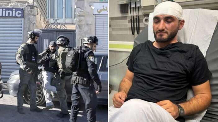 İsrail polisinin saldırdığı AA muhabiri hastaneye kaldırıldı! Silahla vurup yerde tekmeler attılar..