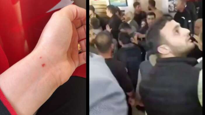 DEM Partililer AK Parti Belediye Başkanına saldırdı! "Oy kullanmamıza engel olmak istediler"