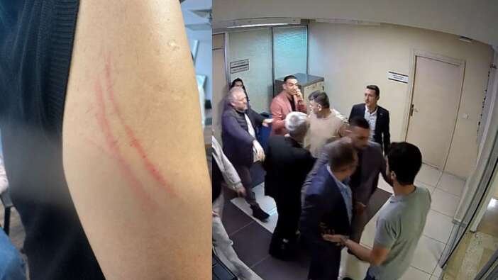 CHP'den Gaziosmanpaşa Belediyesi'ne baskın ve darp iddiası