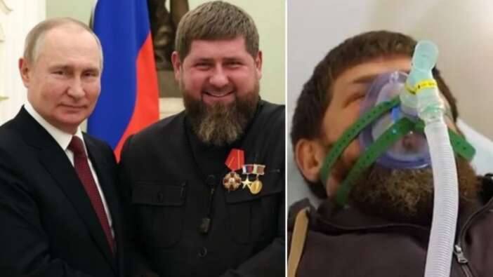 Kadirov'un sağlık durumu kötüye gidiyor! Koltuk savaşı şimdiden başladı...  İşte Kadirov'un yerine geçebilecek 4 kişi!