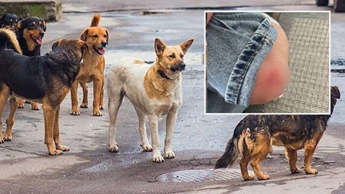 Ankara’da 15 yaşındaki çocuğa sokak köpekleri saldırdı