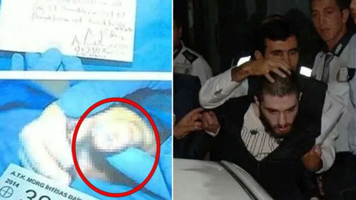 Cem Garipoğlu'nun otopsi fotoğraflarında dikkat çeken detay! Ellerindeki mor lekelerin sırrı çözüldü...