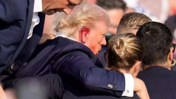 Trump, suikast girişimi sonrası ilk kez bandajsız görüntülendi! Yeni iddialar kafaları karıştırdı...