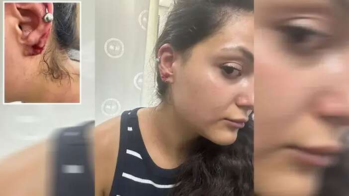 Yalova'da haber yapmak için giden DHA muhabirine saldırdılar