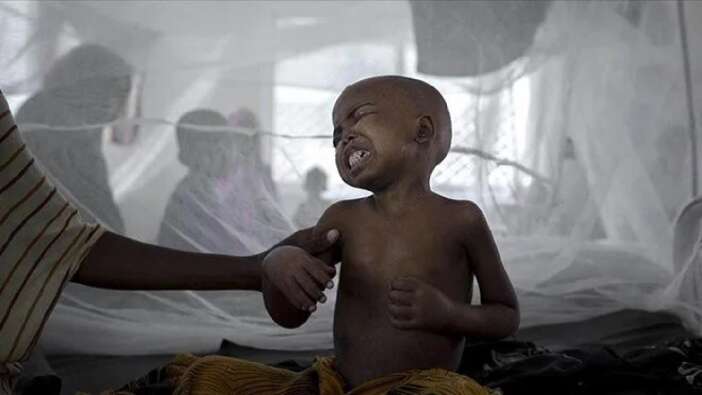 Sudan'da kolera salgını can aldı: Hayatını kaybedenlerin sayısı 672'ye çıktı...