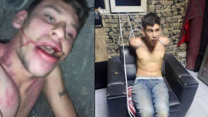 Patron tarafından alıkoyulan işçi 3 gün darbedildi, böcek yedirildi, dişleri kırıldı