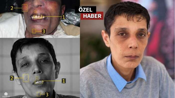 İşte Esad af yalanı! Ünlü aktivist Hamada işkence ile öldürülmüş
