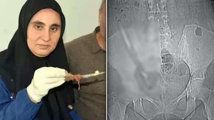 Baş ağrısı şikayetiyle hastaneye gitti, hayatının şokunu yaşadı! Görmeden inanamadı!