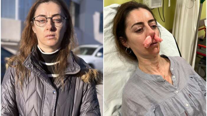 Sokakta gördüğü kadını eşinin sevgilisi sanınca bir anda saldırdı! Kafasını arabanın kapısına sıkıştırıp darp etti