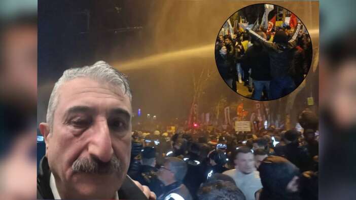 Bursa'daki Ekrem İmamoğlu eylemlerinde CHP İl Başkanı gözünden yaralandı