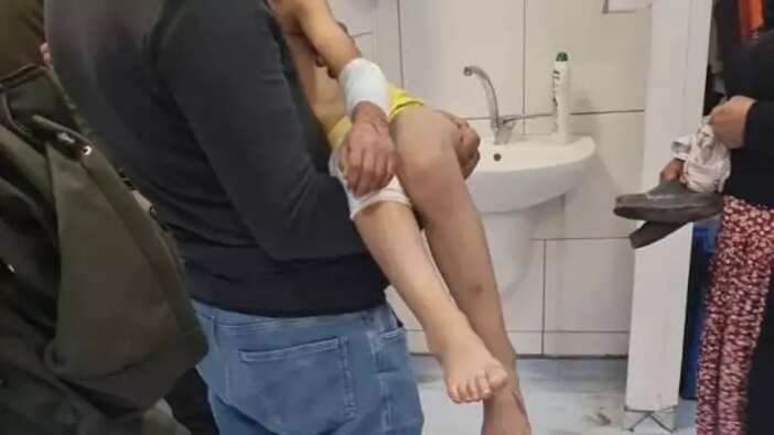 Malatya’da köpekler 9 yaşındaki çocuğa saldırdı! Tedavisi sürüyor...