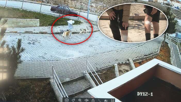 Ankara Çubuk’ta korku dolu anlar: Köpekler çocuklara saldırdı, sahibi olan kadın izledi!