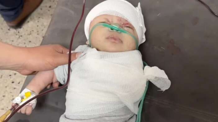 Bebek Katili İsrail! Saldırıda kolu kopan Gazzeli minik bebeğin son hali yürekleri burktu!