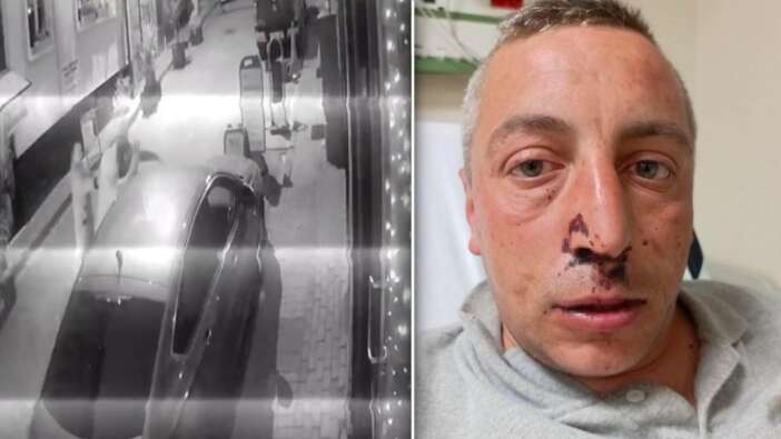 Bu nasıl vicdansızlık! Kocaeli’de engelli vatandaşa sokak ortasında saldırı